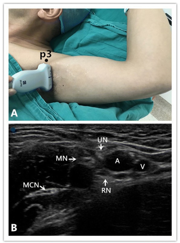 Fig. 2