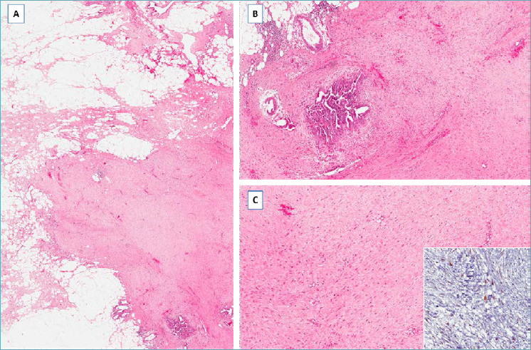 Fig. 13.