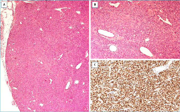 Fig. 11.