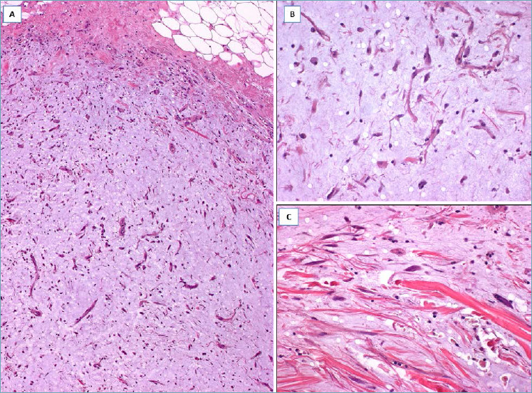 Fig. 12.