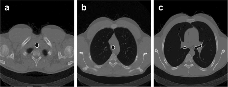 Fig. 4