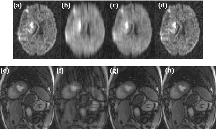 FIG. 4.