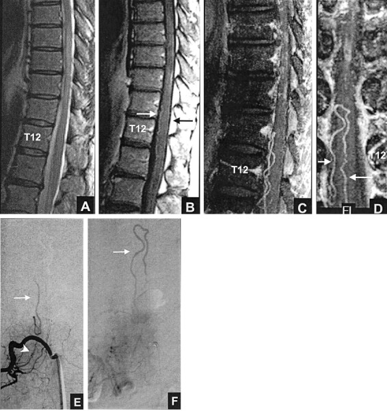 Fig 2.