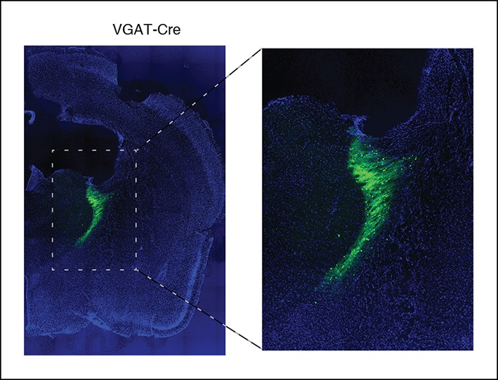 Figure 1—figure supplement 5.