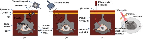 Fig. 11