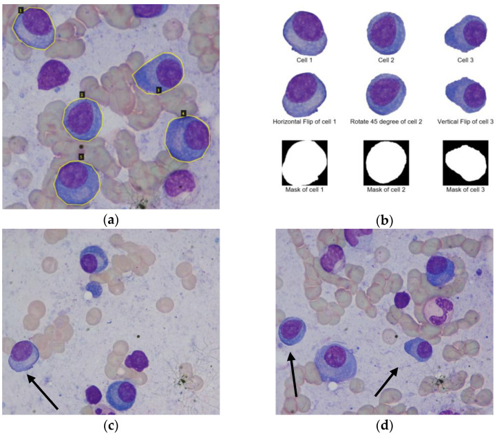 Instance Segmentation of Multiple Myeloma Cells Using Deep-Wise Data ...