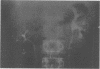 363