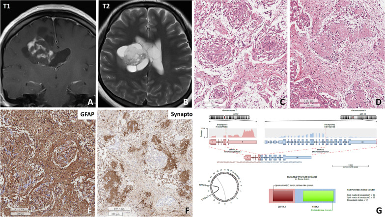 Fig. 2