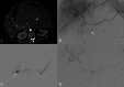 Fig 2 –