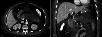 Fig 1 –