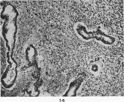 Fig. 14