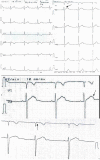 Fig 4b
