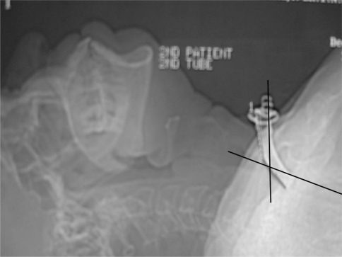 Fig. 1
