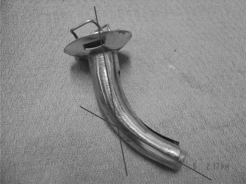 Fig. 2