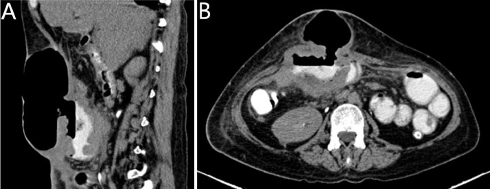 Fig 6 –