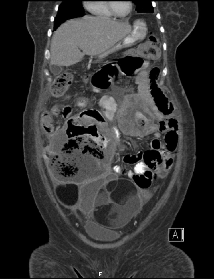Fig 2 –