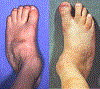 Fig. 99.