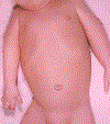 Fig. 73.