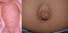 Fig. 44.