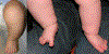 Fig. 85.