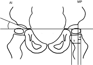 Fig. 1