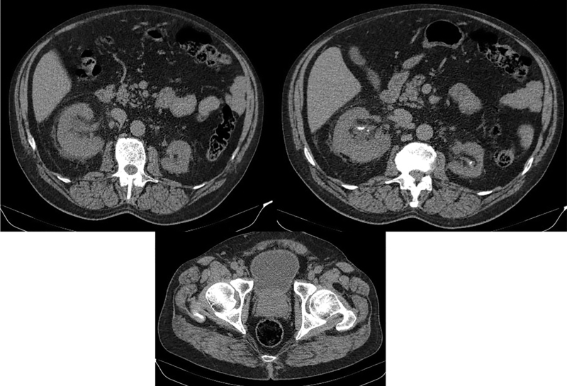 FIG. 2.