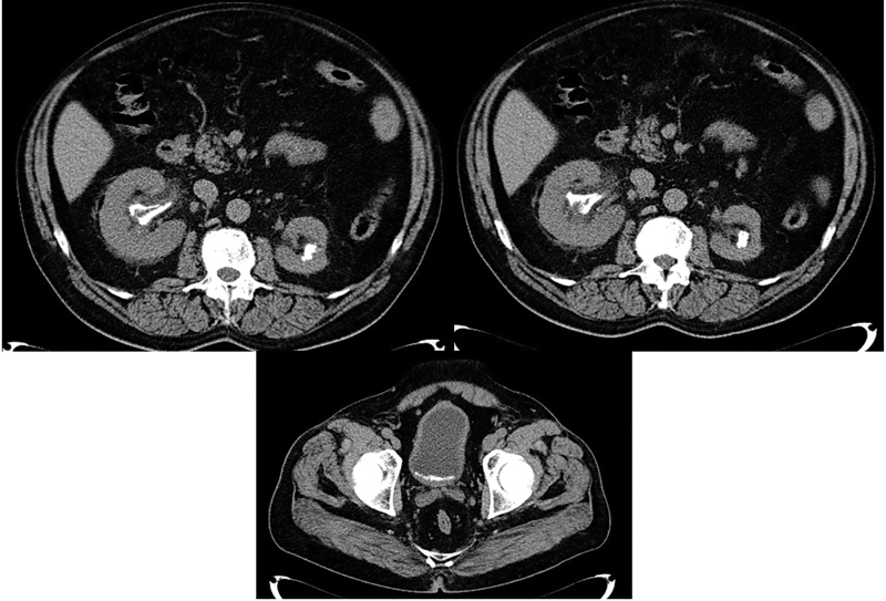 FIG. 1.