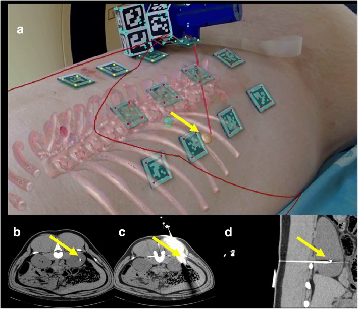 Fig. 4