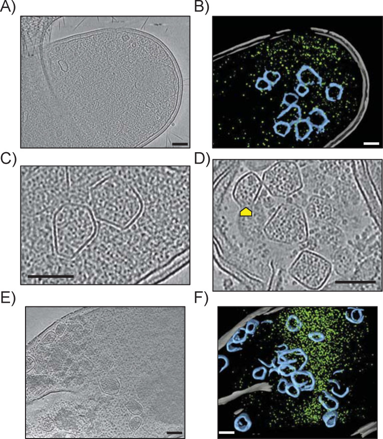 Microscopy of bacterial cells shows localization and structure of cellular components. Electron cryotomograpgy captures and segmentation images for WT and Δeut pEut strains.