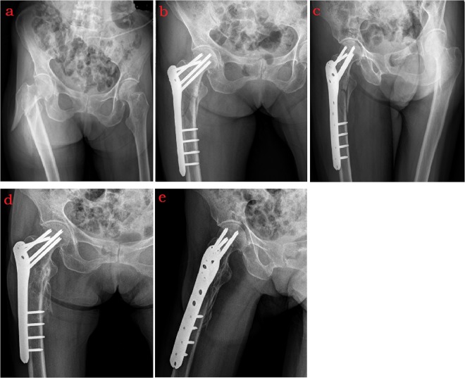 Figure 2