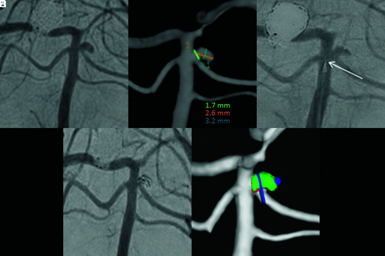 FIG 2.