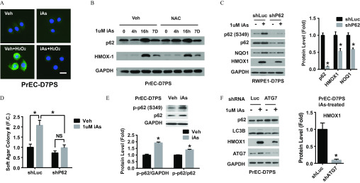 Figure 4A displays intercellular levels of reactive oxygen species (ROS) in PrEC-D7PS, including Veh, iAs, Veh plus H subscript 2 O subscript 2, and iAs plus H subscript 2 O subscript 2. Figure 4B is a western blot titled PrEC-D7PS, displaying columns, namely, 0, 4h, 16h, and 7D for Veh and 0, 4h, 16h, and 7D for NAC across rows, namely, 1 microMolar iAs, p62, HMOX1, GAPDH. Figure 4C is a western blot titled RWPE1-D7PS, displaying columns, namely, negative and positive for shLuc and negative and positive for shP62 across row, namely, 1 microMolar iAs, p62 (S349), p62, NQO1, HMOX1, GAPDH. A bar graph plots protein level (fold), ranging from 0.0 to 1.5 with increments of 0.5 (y-axis) across p62, HMOX1, and NOQ1 for shLuc and shP62. Figure 4D is a bar graph, plotting soft agar colony number (F.C.), ranging from 0.0 to 2.5 with increments of 0.5 (y-axis) across shLuc and shP62 (x-axis) for Veh and 1 microMolar iAs. Figure 4E is a western blot, displaying columns, namely, Veh and iAs for PrEC-D7PS across rows, namely, p-p62 (S349), p62, and GAPDH. A bar graph plots protein level (Fold), ranging from 0.0 to 2.5 with increments of 0.5 (y-axis) across p-p62 per GAPDH and p-p62 per p62 for Veh and iAs. Figure 4F is a western blot titled PrEC-D7PS, displaying columns, namely, negative and positive for Luc and negative and positive for ATG7 across rows, namely, shRNA, 1 microMolar iAs, p62, LC3B, HMOX1, ATG7, and GAPDH. A bar graph titled PrEC-D7PS iAs-treated, plotting protein level (Fold), ranging from 0.0 to 1.5 with increments of 0.5 (y-axis) across shLuc and shATG7 for HMOX1.