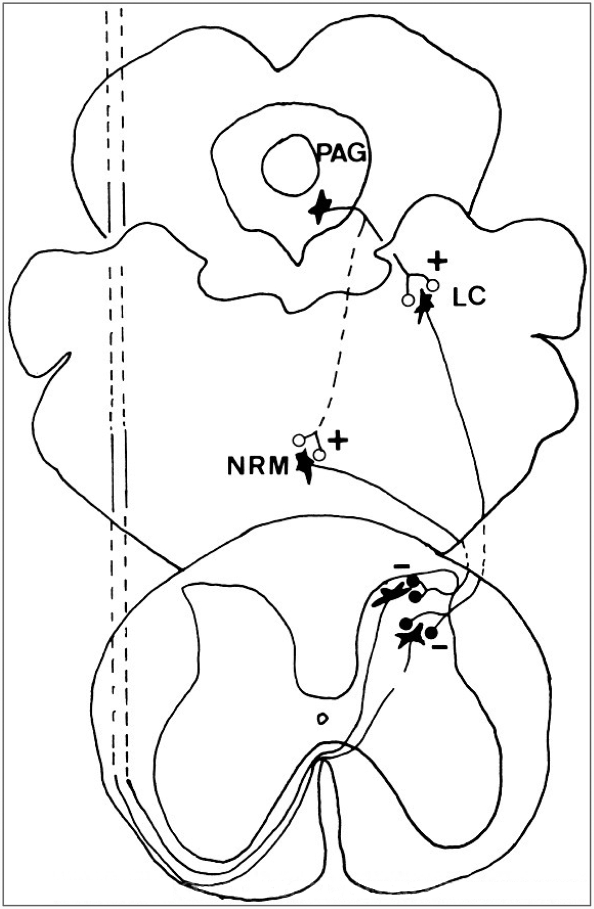 FIG. 14.