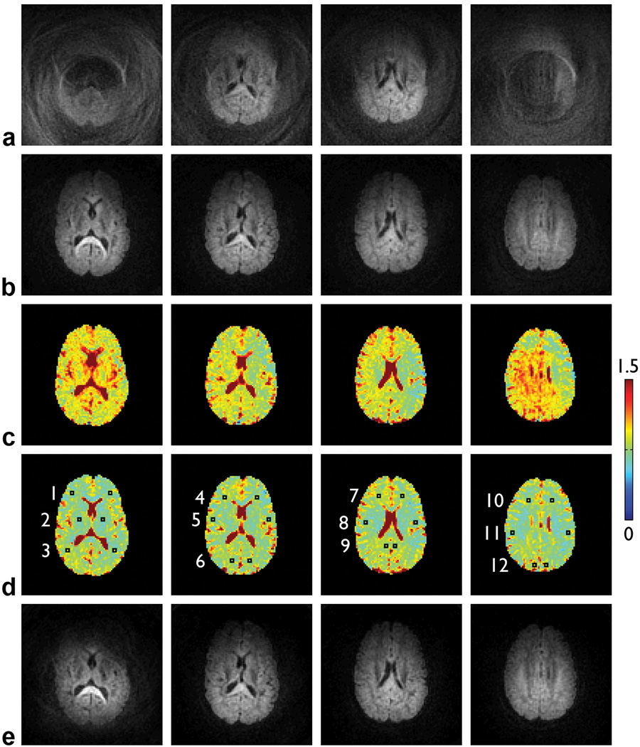 FIG. 4