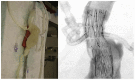 Fig. 15