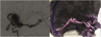 Fig. 10
