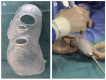 Figure 16