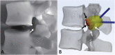 Fig. 26