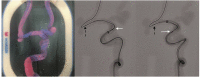 Fig. 9