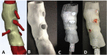 Fig. 14