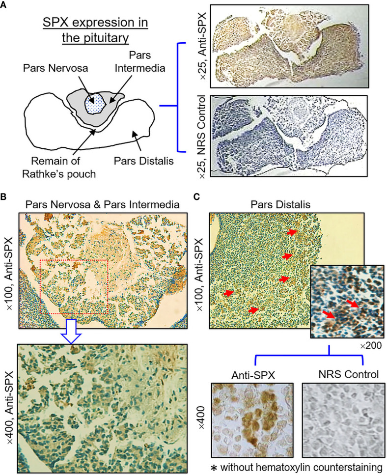 Figure 11