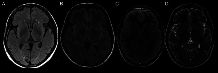 FIG. 1