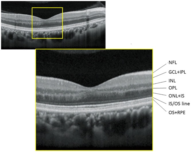 Fig 1