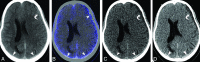 Fig 3.