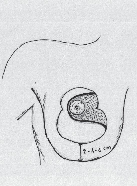 Diagram 35