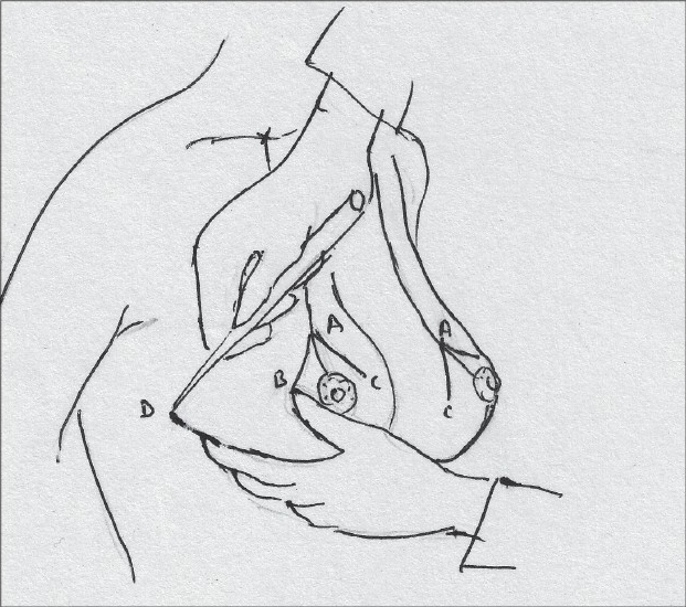 Diagram 15