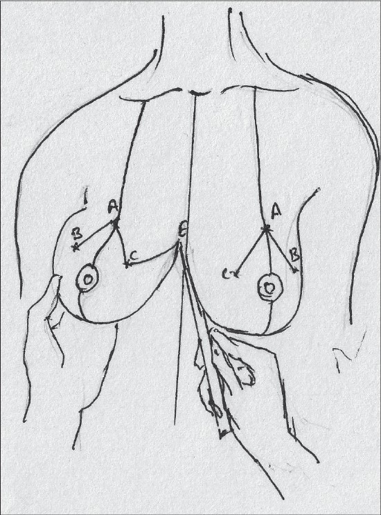 Diagram 13