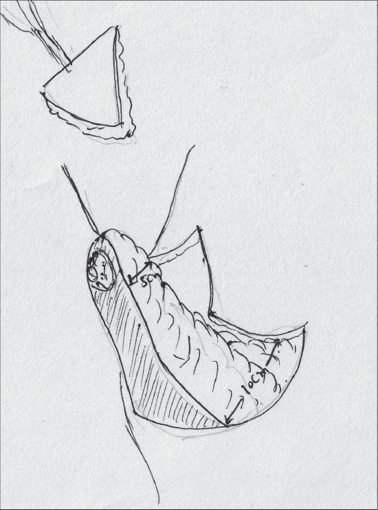 Diagram 22
