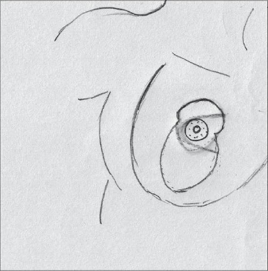 Diagram 30