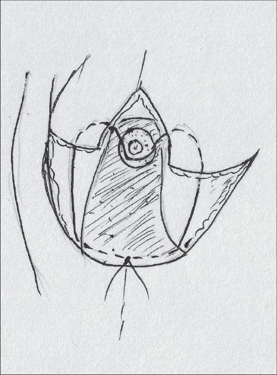 Diagram 23